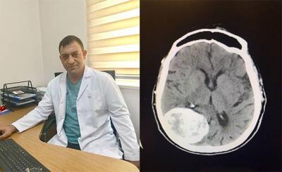 Op.Dr.Mustafa ��k�l�'n�n tedavi etti�i beyin t�m�r� vakalar�n�n say�s� 5�e ula�t�.